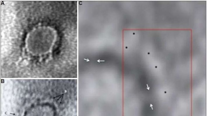 Photo of Corona virus picture released by National Institute of Virology in India